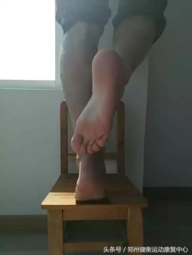 跟腱炎的治疗最好的方法,跟腱炎做什么运动恢复视频