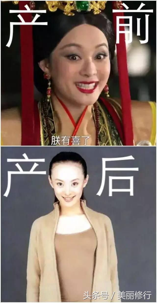 掉头发用防脱洗发水,掉头发买防脱洗发水有效没