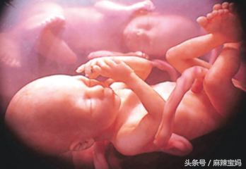 孕30周脐带绕颈2周胎位不正怎么办,24周胎儿脐带绕颈2周怎么办