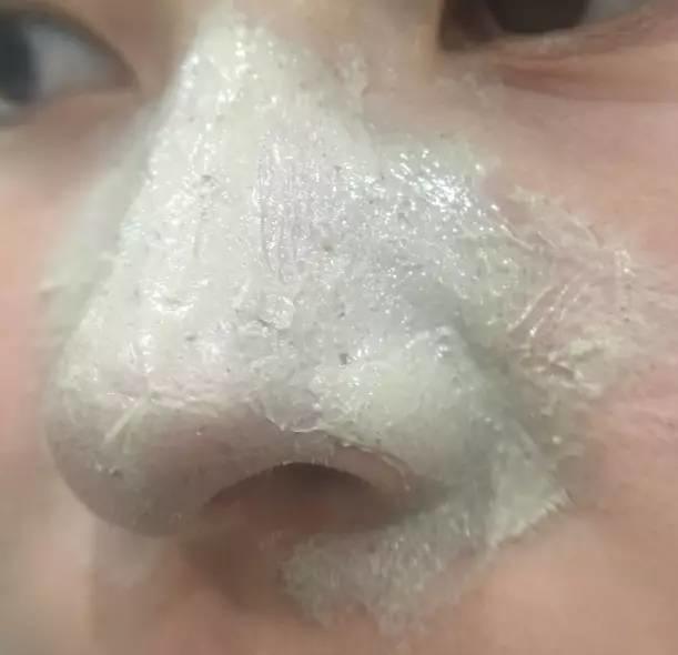 rydeen白泥清洁泥膜效果怎么样,平价好用的清洁泥膜测评