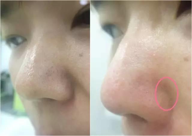 rydeen白泥清洁泥膜效果怎么样,平价好用的清洁泥膜测评