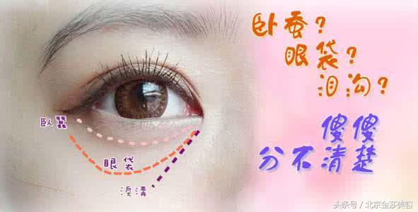 泪沟和眼袋有什么区别?预防及治疗方法有哪些?