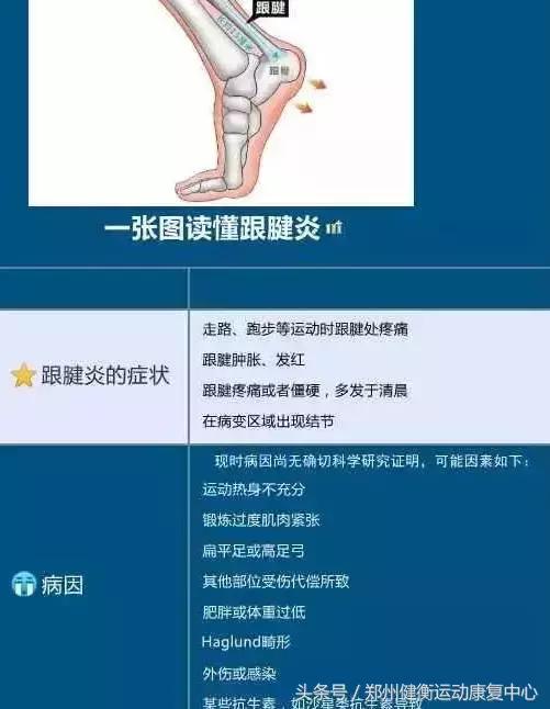 跟腱炎的治疗最好的方法,跟腱炎做什么运动恢复视频