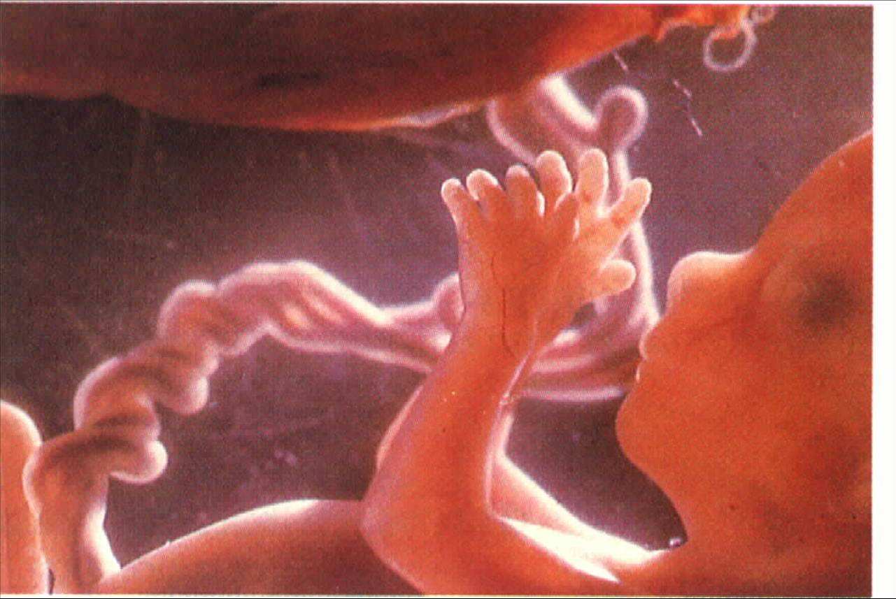 孕妇羊水是每天都不一样吗,关于羊水你知道多少