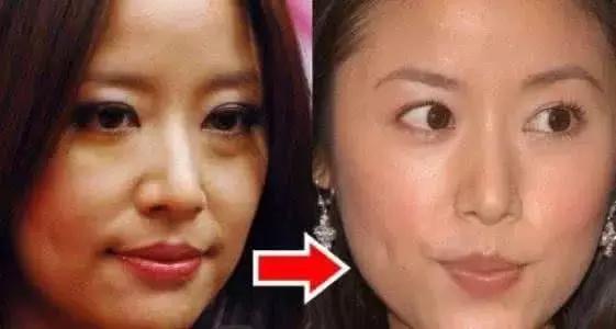 宋祖儿最好看的眼妆,宋祖儿怎么祛眼袋