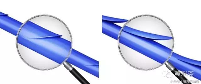 脸垮是先提拉还是填充,脸垮做什么医美没套路