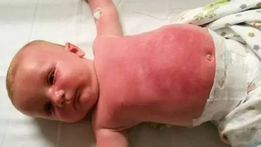 进藏最好用的防晒推荐一下,进藏必买的防晒乳有哪些