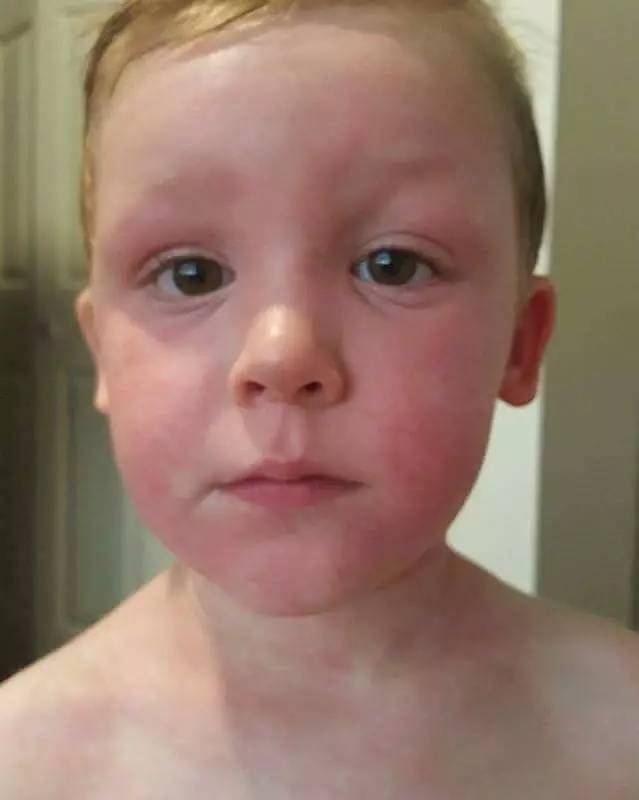 进藏最好用的防晒推荐一下,进藏必买的防晒乳有哪些