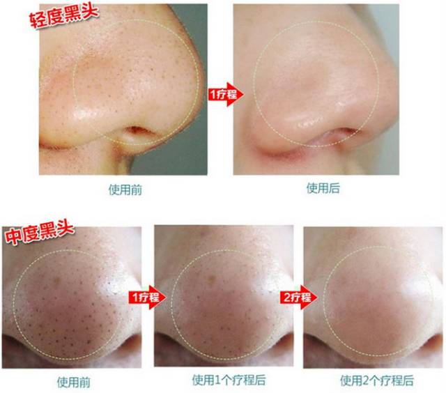 妆前三分钟快速补水面膜,搞定早晚护肤的涂抹面膜