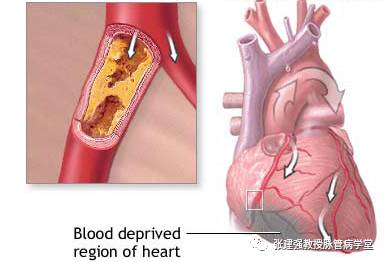 怎么让血管不长斑,消除血管斑的最佳方法