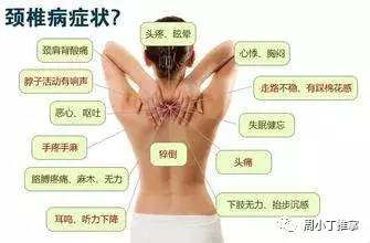 颈肩腰腿痛诊疗学,颈肩腰腿痛的锻炼