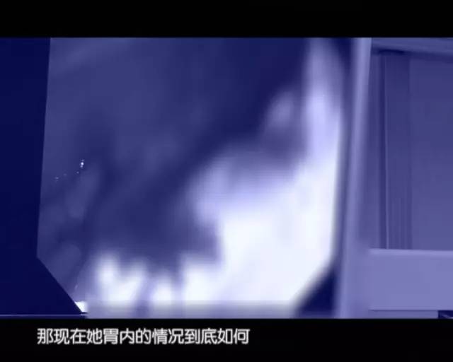 哪些人必须要做胃镜,什么样的人要做胃镜