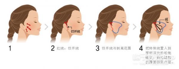 振动棒、腋下贴还送拉皮手术?奥斯卡大礼包脑洞可真大...