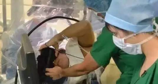 惊呆了！世界首例脑癌患者戴VR头盔切除肿瘤