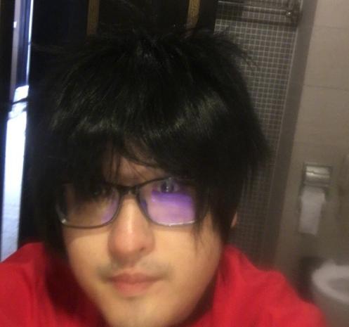 德云色笑笑近况,德云色笑笑植发后现在效果如何