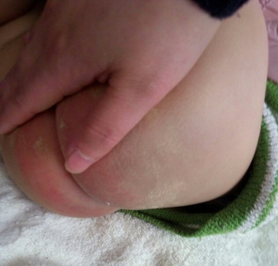 适合宝妈的爽身粉有哪些成分,婴儿爽身粉出事视频