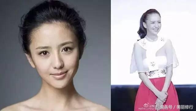 掉头发用防脱洗发水,掉头发买防脱洗发水有效没