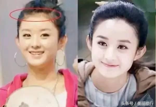 掉头发用防脱洗发水,掉头发买防脱洗发水有效没