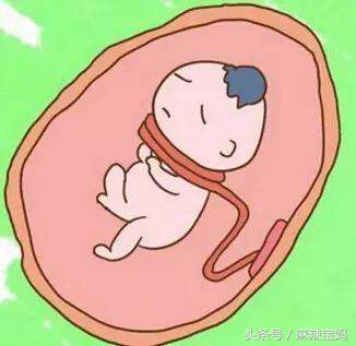 孕30周脐带绕颈2周胎位不正怎么办,24周胎儿脐带绕颈2周怎么办