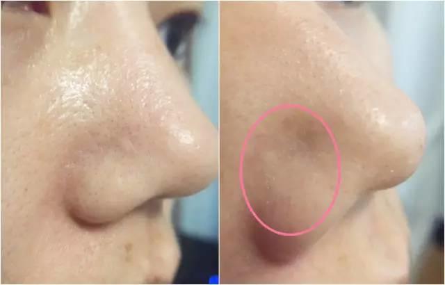 rydeen白泥清洁泥膜效果怎么样,平价好用的清洁泥膜测评