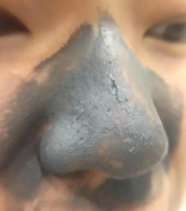 rydeen白泥清洁泥膜效果怎么样,平价好用的清洁泥膜测评