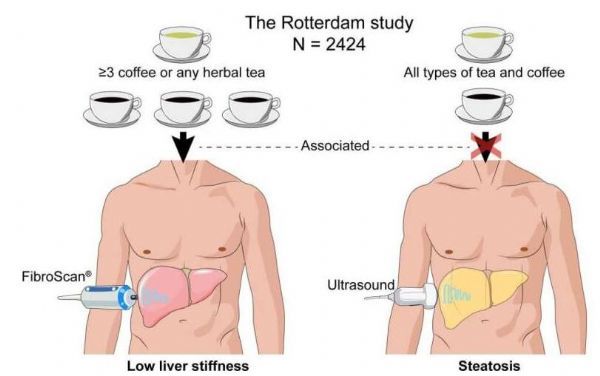肝不好为什么不建议喝茶和咖啡,为什么常喝咖啡对肝脏有好处