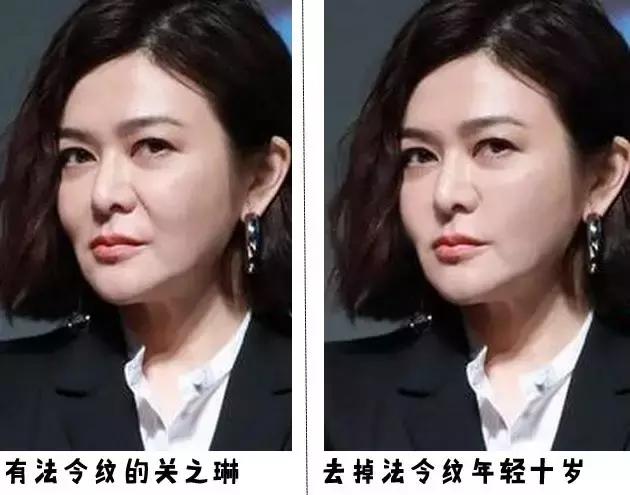 爱笑的人会有属于自己的法令纹,天生法令纹就很深怎么办又不爱笑