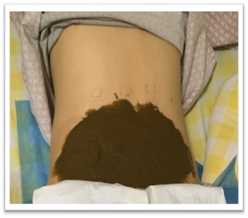 调经促孕丸中药,调经促孕十三针