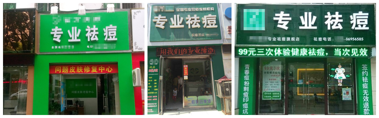 怎样判断自己是不是激素脸,如何判断激素脸和过敏脸