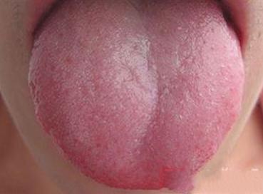 脸上的白癜风发展的太快好冶吗,在这个看脸的时代颜值有多重要