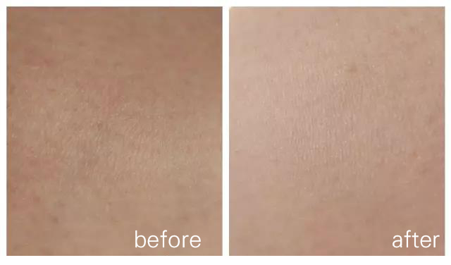 厨房里的护肤技能，你和白就只差一袋红糖的距离