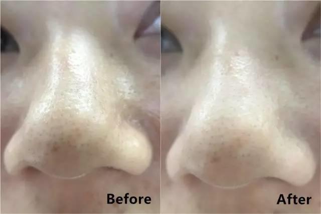 rydeen白泥清洁泥膜效果怎么样,平价好用的清洁泥膜测评