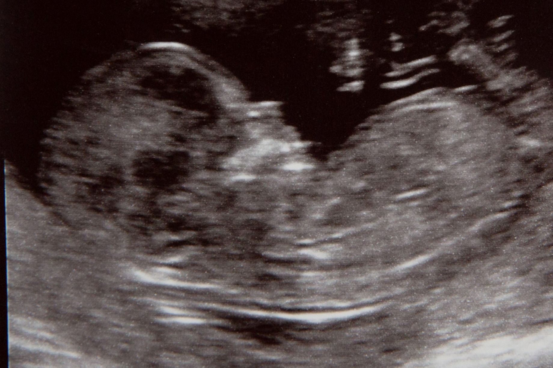 准妈妈必看孕期运动注意事项,孕期1-40周检查表明细表