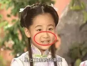 爱笑的人会有属于自己的法令纹,天生法令纹就很深怎么办又不爱笑