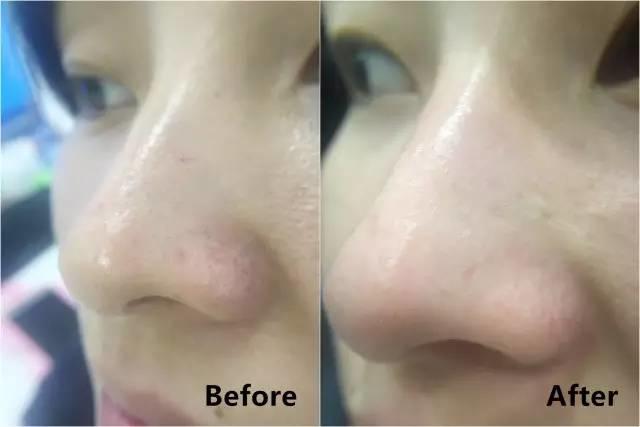 rydeen白泥清洁泥膜效果怎么样,平价好用的清洁泥膜测评