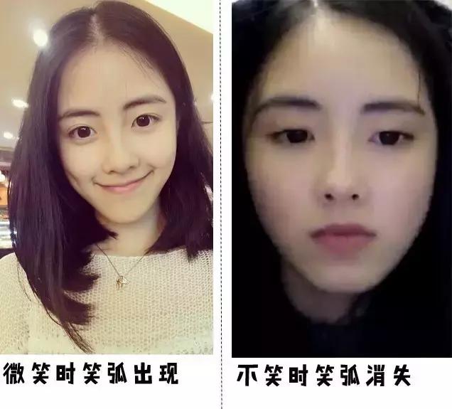 爱笑的人会有属于自己的法令纹,天生法令纹就很深怎么办又不爱笑