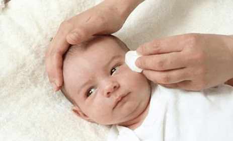 新生儿有眼屎怎么处理最好方法,新生儿有眼屎处理小妙招