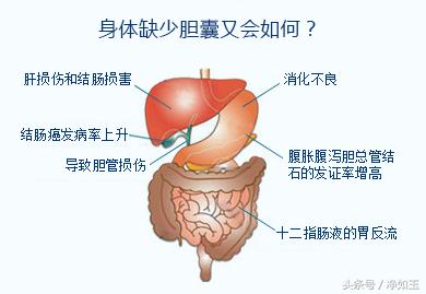 胆结石治疗方法和注意事项,胆结石正确治疗方法