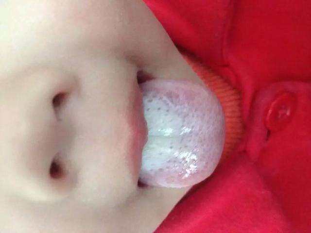 母乳宝宝体检不合格,母乳喂养的孩子健康吗