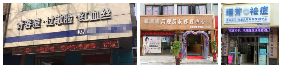 怎样判断自己是不是激素脸,如何判断激素脸和过敏脸