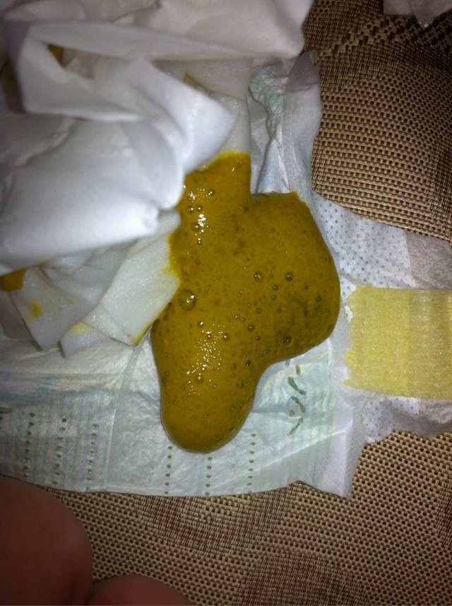 宝宝伤寒拉肚子,为什么很多孩子拉肚子