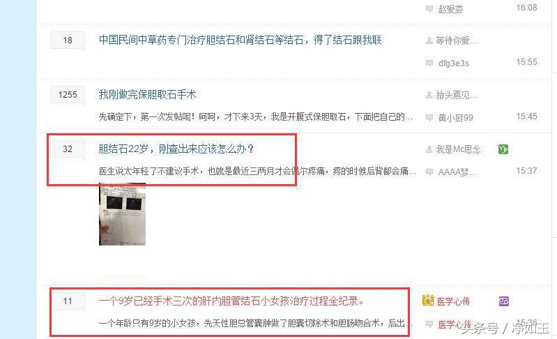 胆结石治疗方法和注意事项,胆结石正确治疗方法