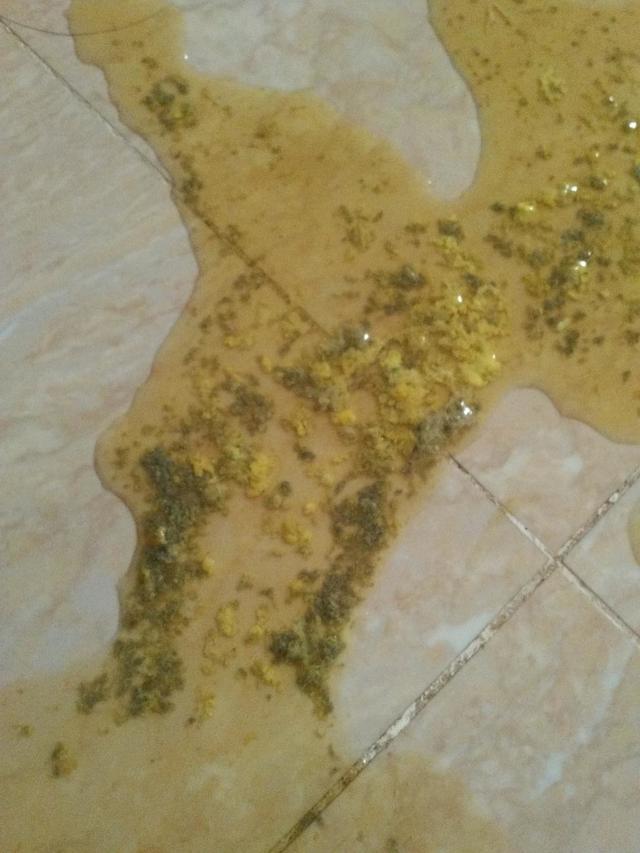 宝宝伤寒拉肚子,为什么很多孩子拉肚子