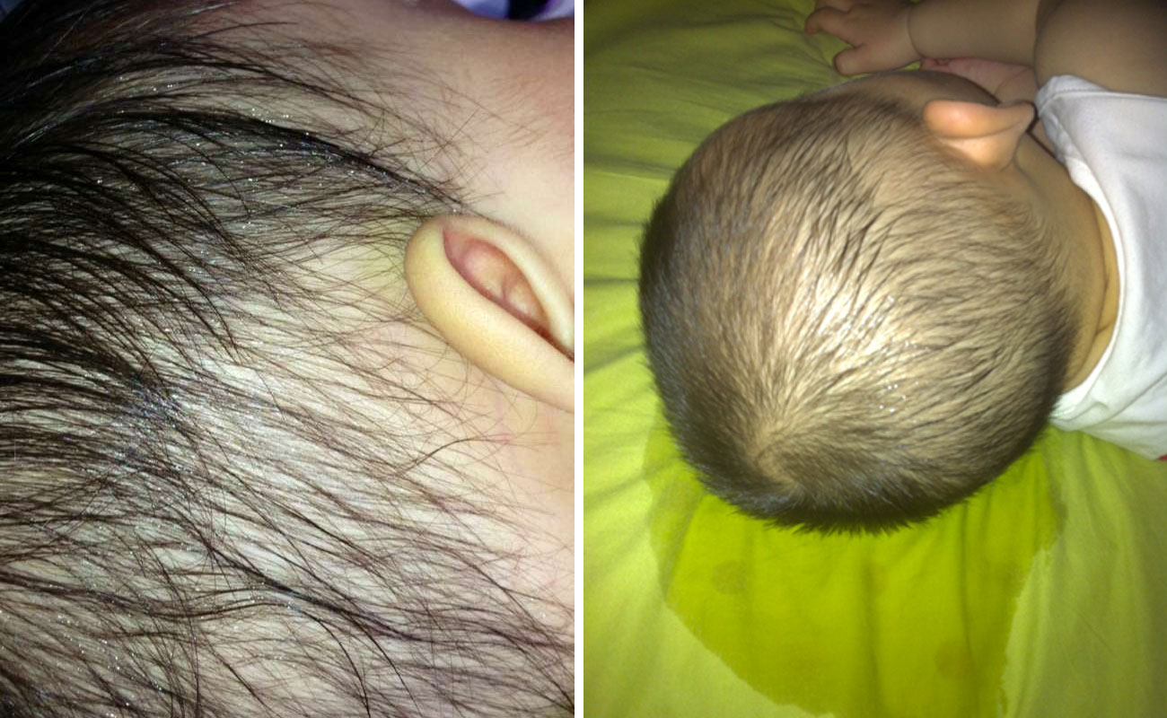 宝宝头部爱出汗怎么回事,宝宝头部出汗特别多是缺锌吗