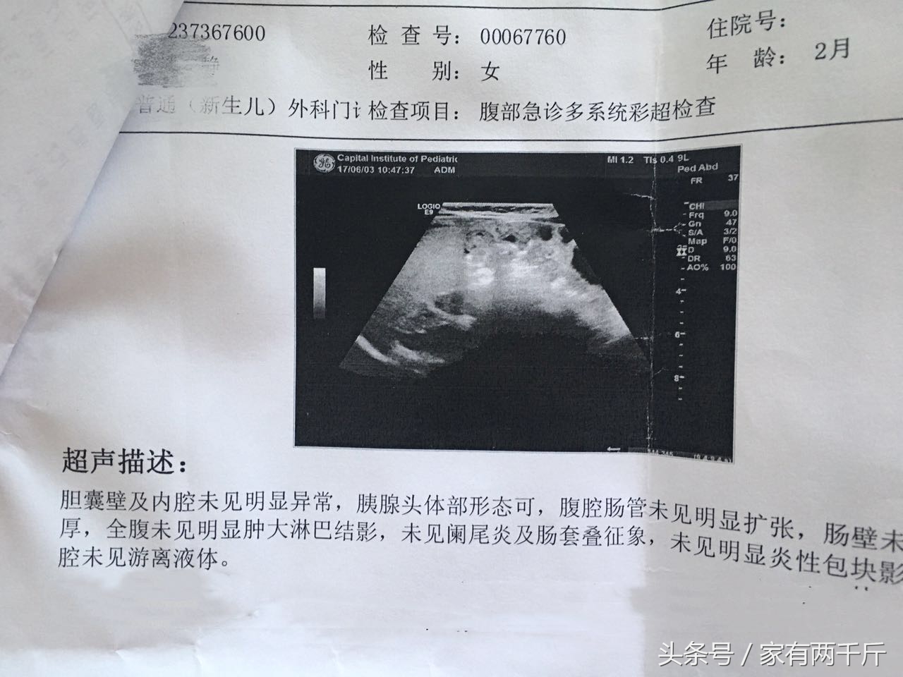 宝宝莫名哭闹小心是肠绞痛,宝宝异常哭闹睡不踏实