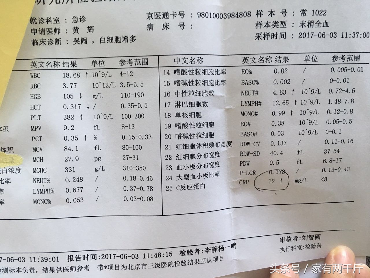 宝宝莫名哭闹小心是肠绞痛,宝宝异常哭闹睡不踏实