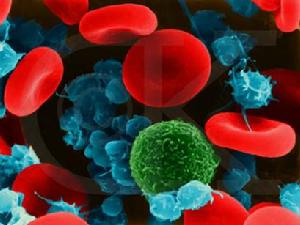 血液病红细胞增多,血液病红细胞增多症能治好吗