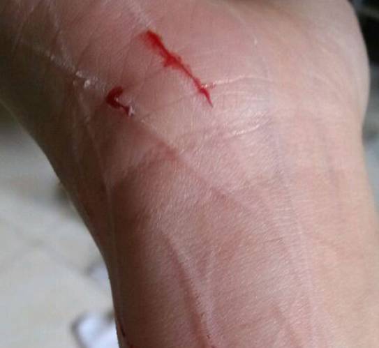 猫咪牙齿被划伤,猫咪牙齿被磕碎了