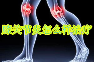 老年退化性膝关节炎怎么治疗,留普安治疗膝关节炎效果好吗