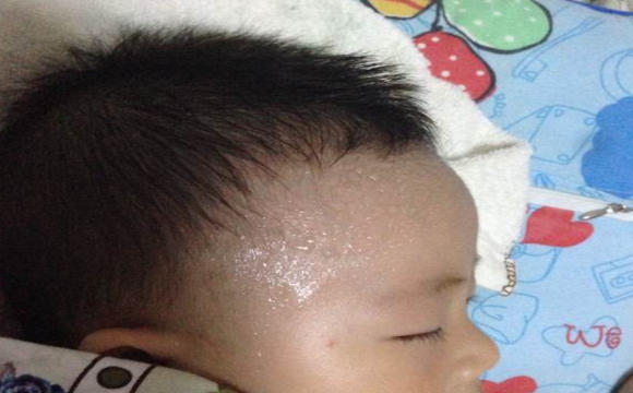 宝宝头部爱出汗怎么回事,宝宝头部出汗特别多是缺锌吗